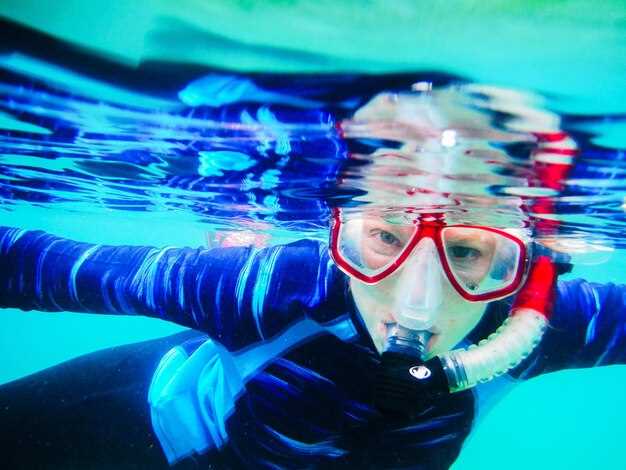 What Is TMS? Essential Considerations Before You Dive In